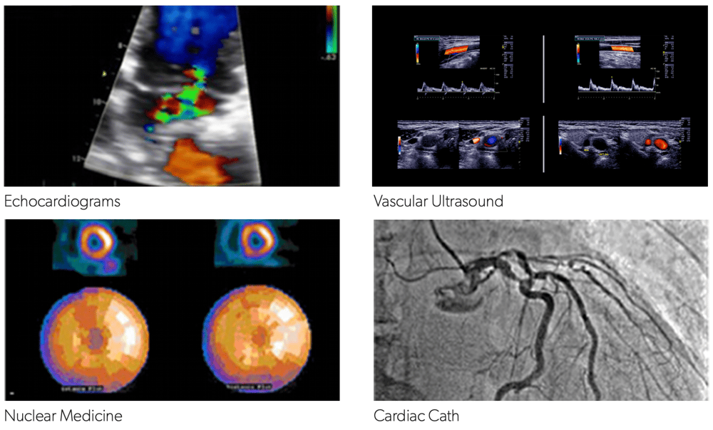 Echocardiograms, vascular ultrasound, nuclear medicine, cardiac catheterization Echocardiograms, vascular ultrasound, nuclear medicine, cardiac catheterization