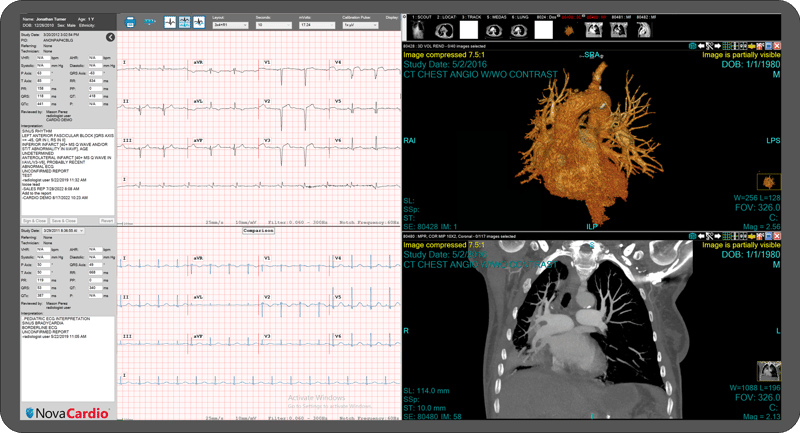 image 5 Cardio