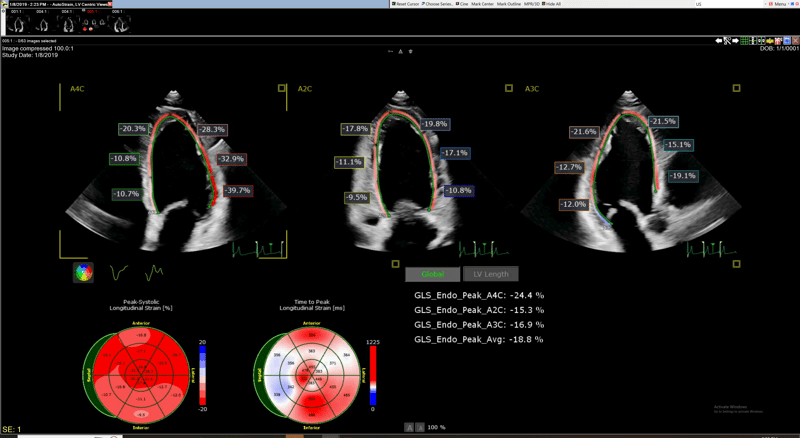 Cardiac MRI Images