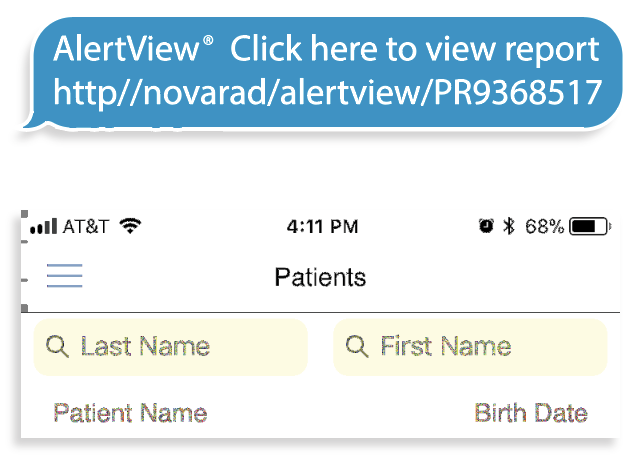 AlertView Alert Example AlertView Alert Example