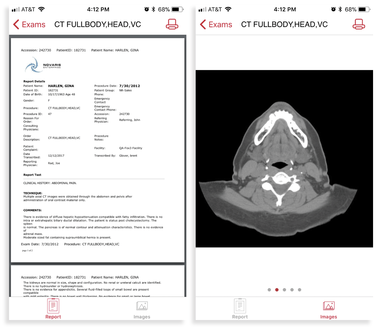 AlertView Example Images AlertView Example Images