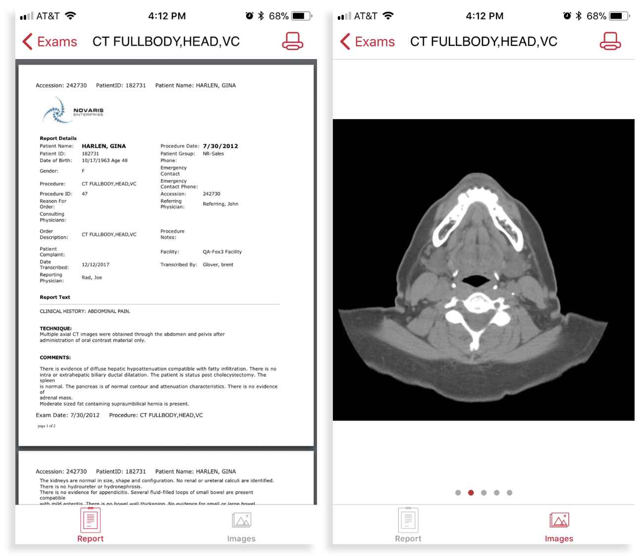 AlertView-Example-Images (1)