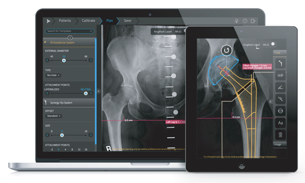 NovaOrtho Screens on Devices NovaOrtho Screens on Devices