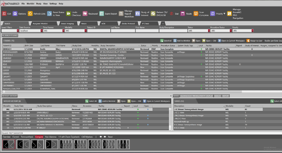 MammoIQ mammography PACS interface displaying breast imaging worklist and study management tools